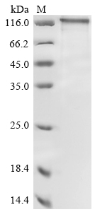 Severe acute respiratory syndrome coronavirus 2 Spike glycoprotein Protein