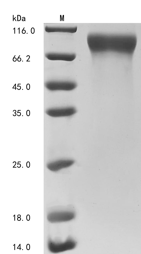 Human CSF1R Protein