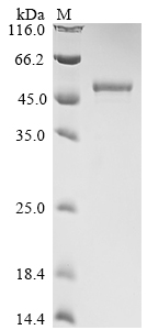 Bat coronavirus 133/2005 Nucleoprotein Protein