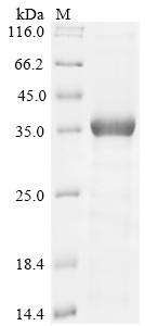 Human USP6 Protein