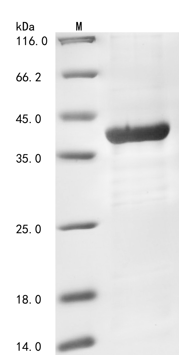 Human TYK2 Protein