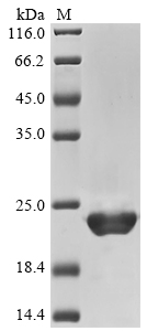 Human IL1B Protein