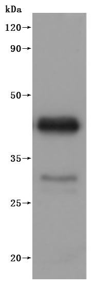 MS4A1-VLPs Protein
