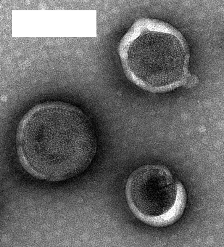 Human SSTR2-VLPs Protein