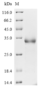 Severe acute respiratory syndrome coronavirus 2 Spike glycoprotein Protein