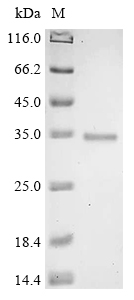 Recombinant Sphingobium sp. Beta-etherase (ligE)