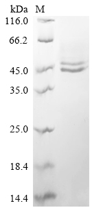 Recombinant Human Interleukin-12 subunit beta (IL12B)