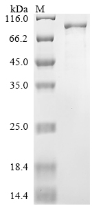 Recombinant Severe acute respiratory syndrome coronavirus 2 Replicase polyprotein 1ab (rep), partial