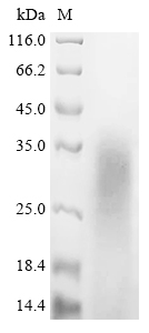 Recombinant Mouse Myelin basic protein (Mbp)