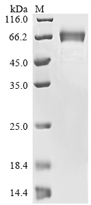 Recombinant Severe acute respiratory syndrome coronavirus 2 Spike glycoprotein (S), partial
