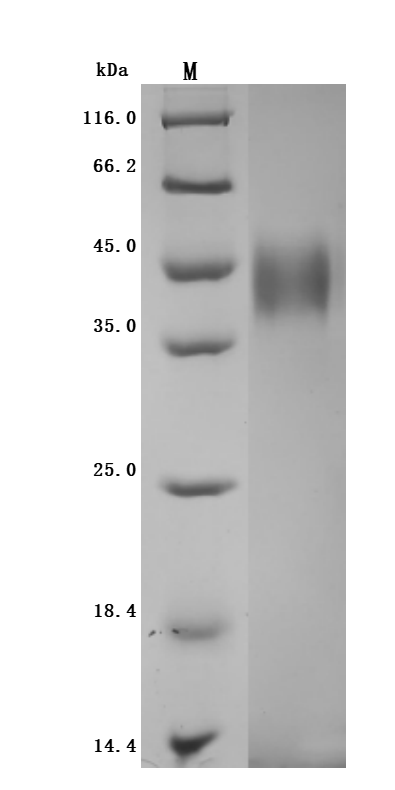 Recombinant Human Tumor-associated calcium signal transducer 2 (TACSTD2), partial (Active)