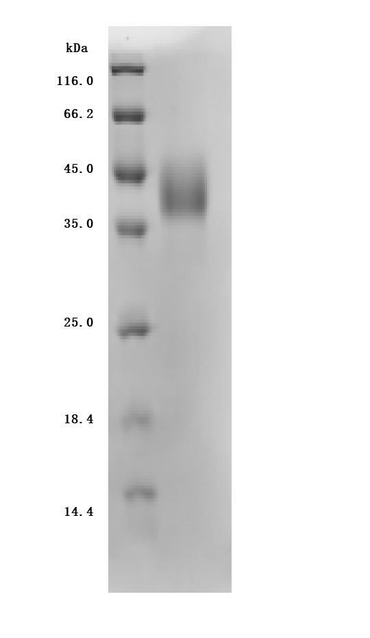 Recombinant Human Tumor-associated calcium signal transducer 2 (TACSTD2), partial (Active)
