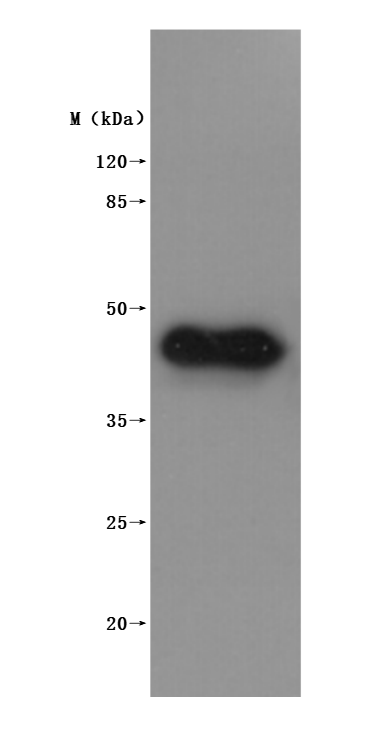 Recombinant Macaca fascicularis Membrane spanning 4-domains A1 (MS4A1)-VLPs (Active)