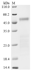 Recombinant Severe acute respiratory syndrome coronavirus 2 Nucleoprotein (N) (P13L,Δ31-33,E136D,R203K,G204R,S413R), partial