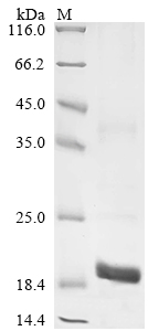 Recombinant Mouse Granulocyte-macrophage colony-stimulating factor (Csf2)