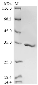 Recombinant Human cytomegalovirus Enhanced green fluorescent protein (egfp)