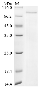 Recombinant Severe acute respiratory syndrome coronavirus 2 Nucleoprotein (N) (P13L,Δ31-33,R203K,G204R)