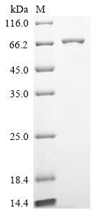 Recombinant Human Ubiquitin carboxyl-terminal hydrolase 26 (USP26), partial