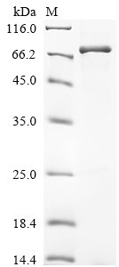 Recombinant Human Serine/threonine-protein kinase RIO3 (RIOK3)