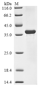 Recombinant Mouse Fibroblast growth factor 5 (Fgf5)