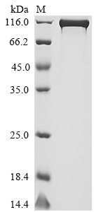 Recombinant Human Dipeptidyl peptidase 4 (DPP4)