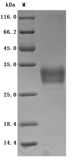 Recombinant Human C-type lectin domain family 4 member C (CLEC4C), partial (Active)