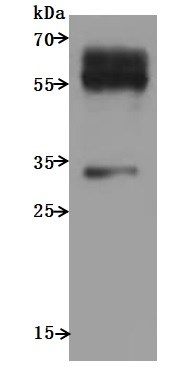 Recombinant Human C-C chemokine receptor type 9 (CCR9)-VLPs (Active)