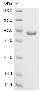 Recombinant Human Delta-like protein 3 (DLL3), partial (Active)