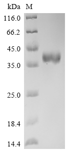 Recombinant Human Delta-like protein 3 (DLL3), partial (Active)