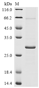 Recombinant Human coronavirus HKU1 Protein I (N)