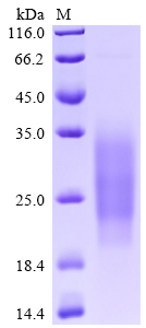 Recombinant Human Single Ig IL-1-related receptor (SIGIRR), partial