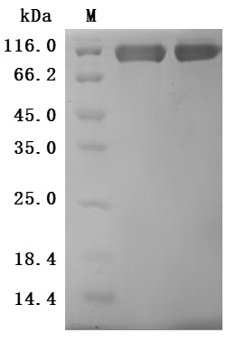 Recombinant Human CUB domain-containing protein 1 (CDCP1), partial (Active)