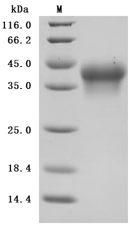 Recombinant Human Interleukin-2 receptor subunit alpha (IL2RA), partial (Active)
