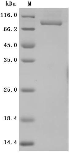 Recombinant Human Transferrin receptor protein 1 (TFRC), partial (Active)