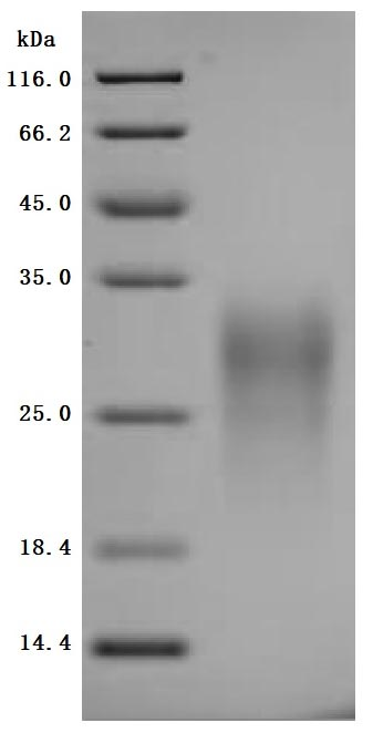 Recombinant Mouse Gastric inhibitory polypeptide receptor (Gipr), partial (Active)