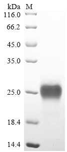 Recombinant Rat Lymphocyte antigen 6 complex locus protein G6d (Ly6g6d) (Active)