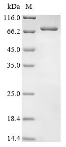 Recombinant Human Interferon kappa (IFNK)