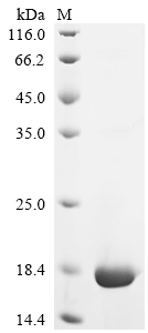 Recombinant Human C-C motif chemokine 3 (CCL3)