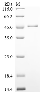 Recombinant Human Serpin H1 (SERPINH1)