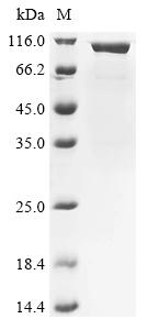 Recombinant Mouse Cholesterol side-chain cleavage enzyme, mitochondrial (Cyp11a1), Biotinylated