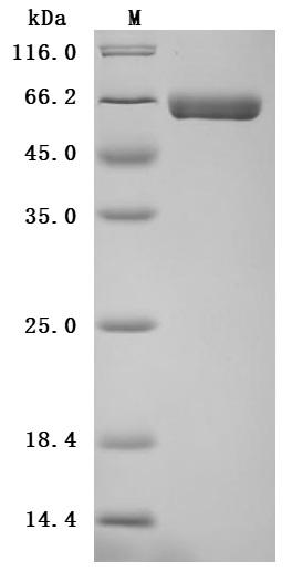 Recombinant Human Alkaline phosphatase, germ cell type (ALPG) (Active)