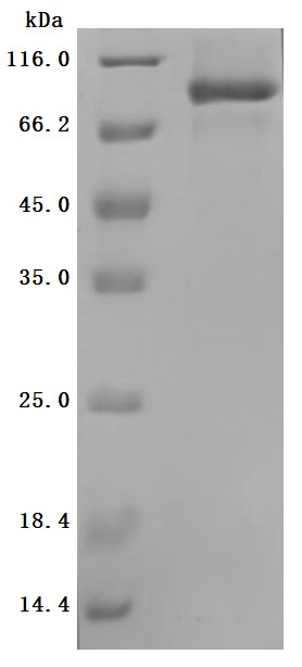 Recombinant Human Desmoglein-2 (DSG2), partial (Active)