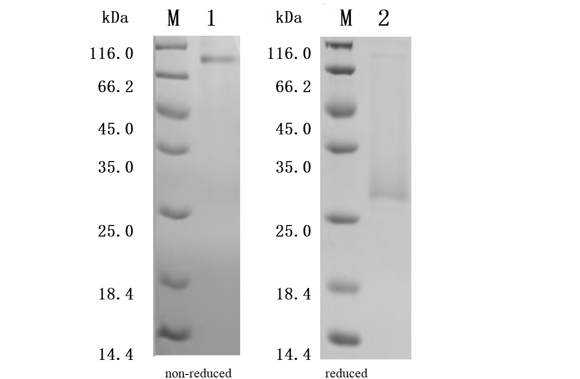 Recombinant Human CD70 antigen (CD70), partial (Active)