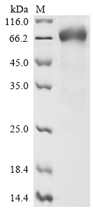 Recombinant Human Interleukin-15 receptor subunit alpha (IL15RA), partial