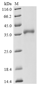 Recombinant Severe acute respiratory syndrome coronavirus 2 Spike glycoprotein (S), partial, Biotinylated