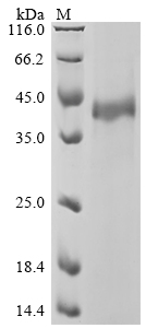 Recombinant Human TGF-beta receptor type-1 (TGFBR1), partial