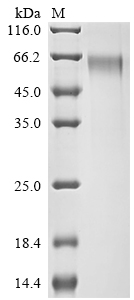 Recombinant Human Syntenin-1 (SDCBP)