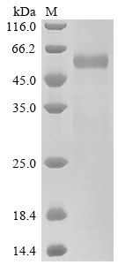 Recombinant Human Placenta growth factor (PGF) (Active)