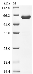 Recombinant Human Insulin-like growth factor-binding protein 7 (IGFBP7)