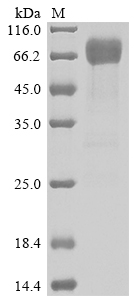 Recombinant Human Interleukin-4 receptor subunit alpha (IL4R), partial